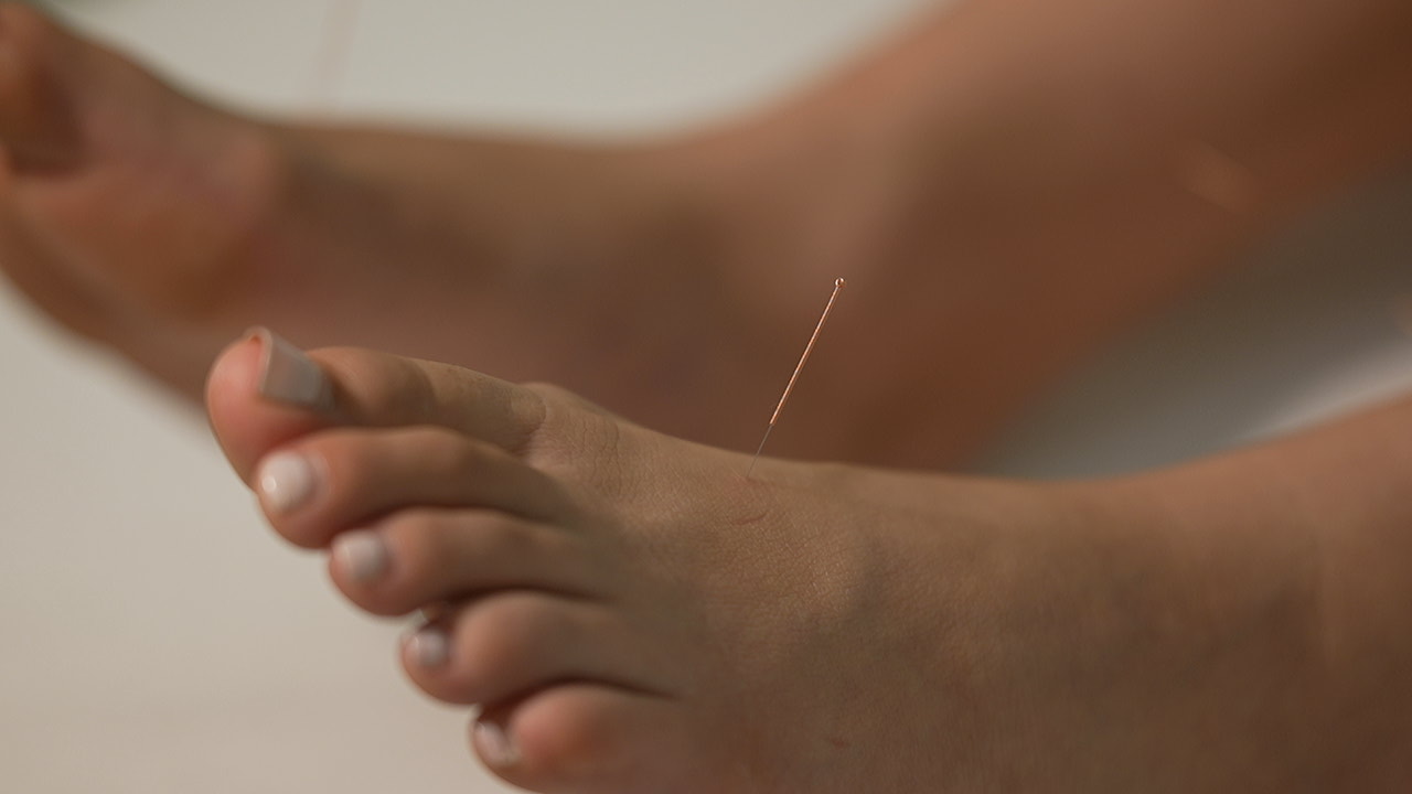 Acupuncture & Traditional Chinese Medicine
