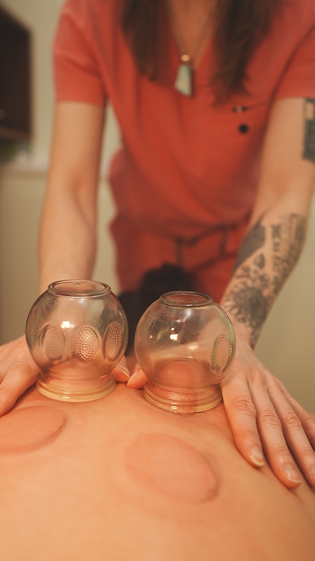 Cupping still 1