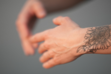 What is Acupuncture, and why do I need it?